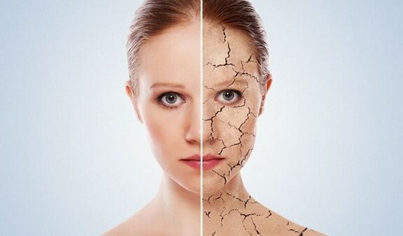 antes y después del rejuvenecimiento de la piel
