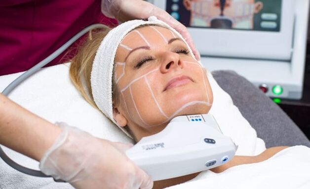 Lifting ultrasónico SMAS para estiramiento facial no quirúrgico