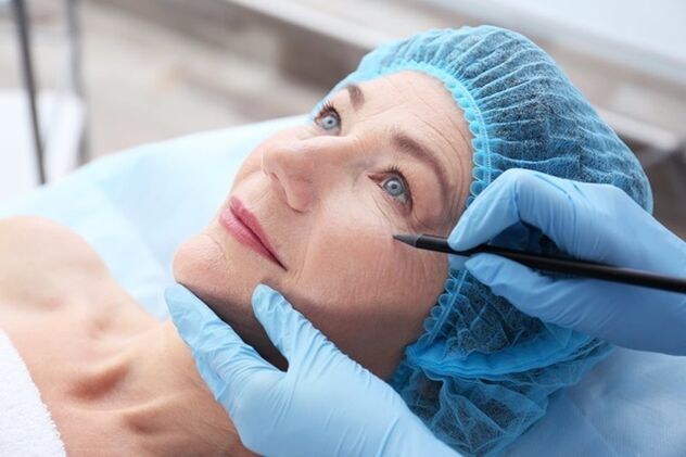 Preparación para un estiramiento facial no quirúrgico