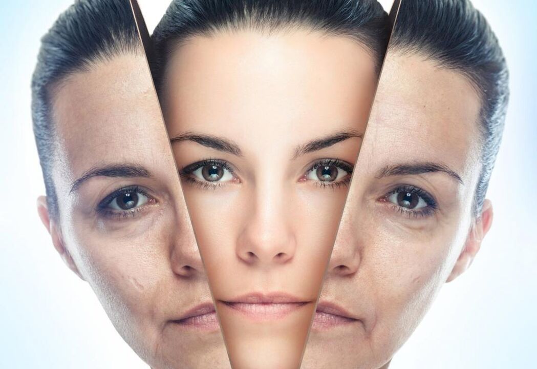 Métodos de rejuvenecimiento facial