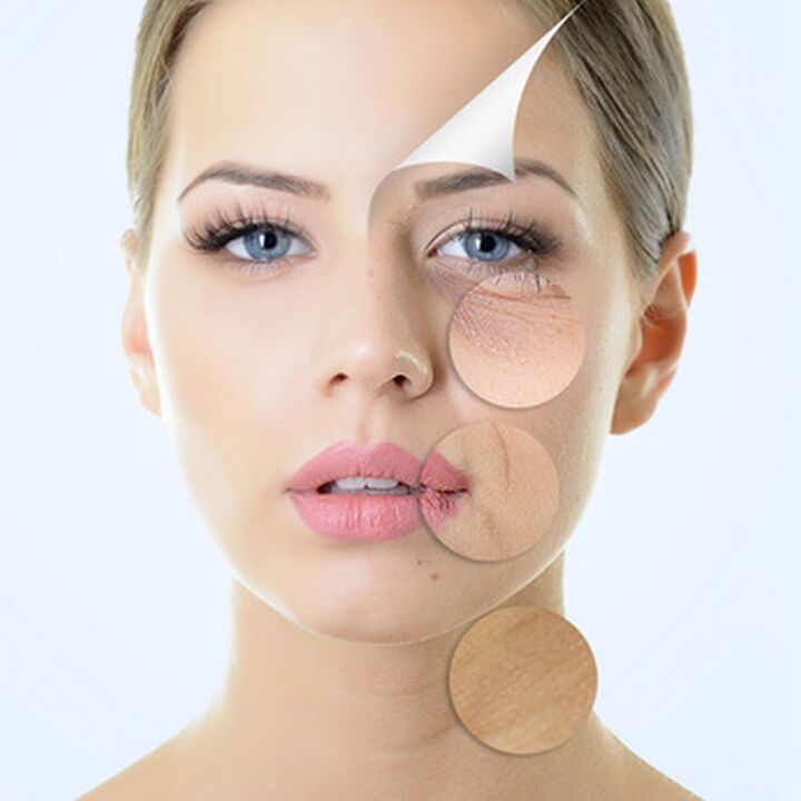 Impurezas de la piel del rostro indicaciones de tratamientos antienvejecimiento. 