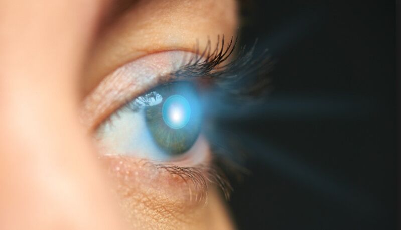 Rejuvenecimiento de la piel del contorno de ojos con láser. 